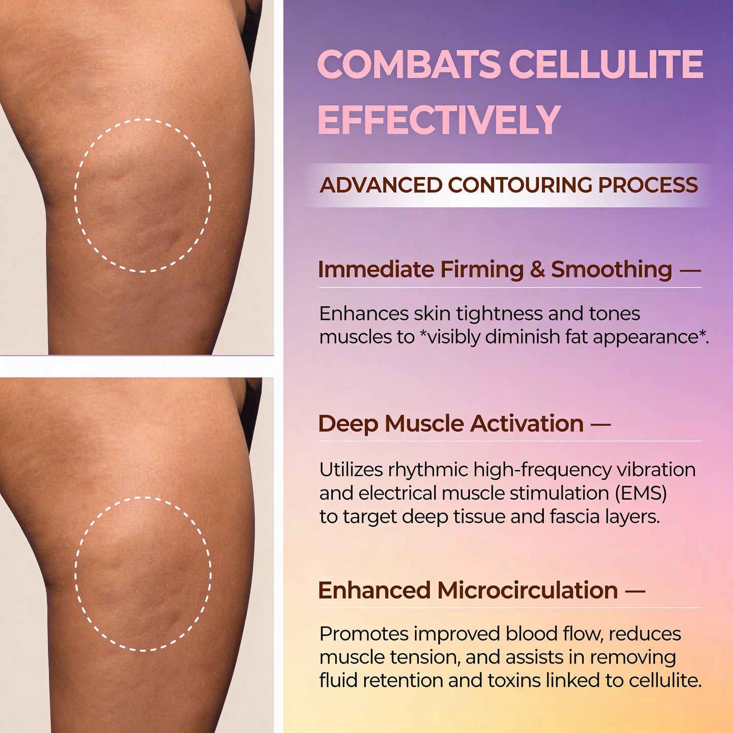 QiRelief Fascia Reliever Tool